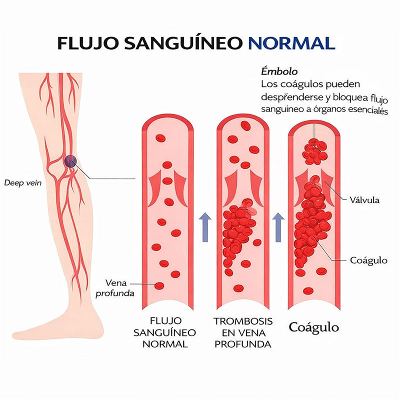 RelaxStep®: Reduce la hinchazón y el dolor por varices sin agujas